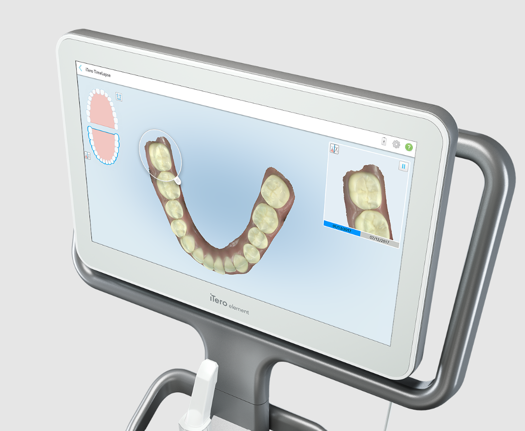 Equipos de tecnología dental digital