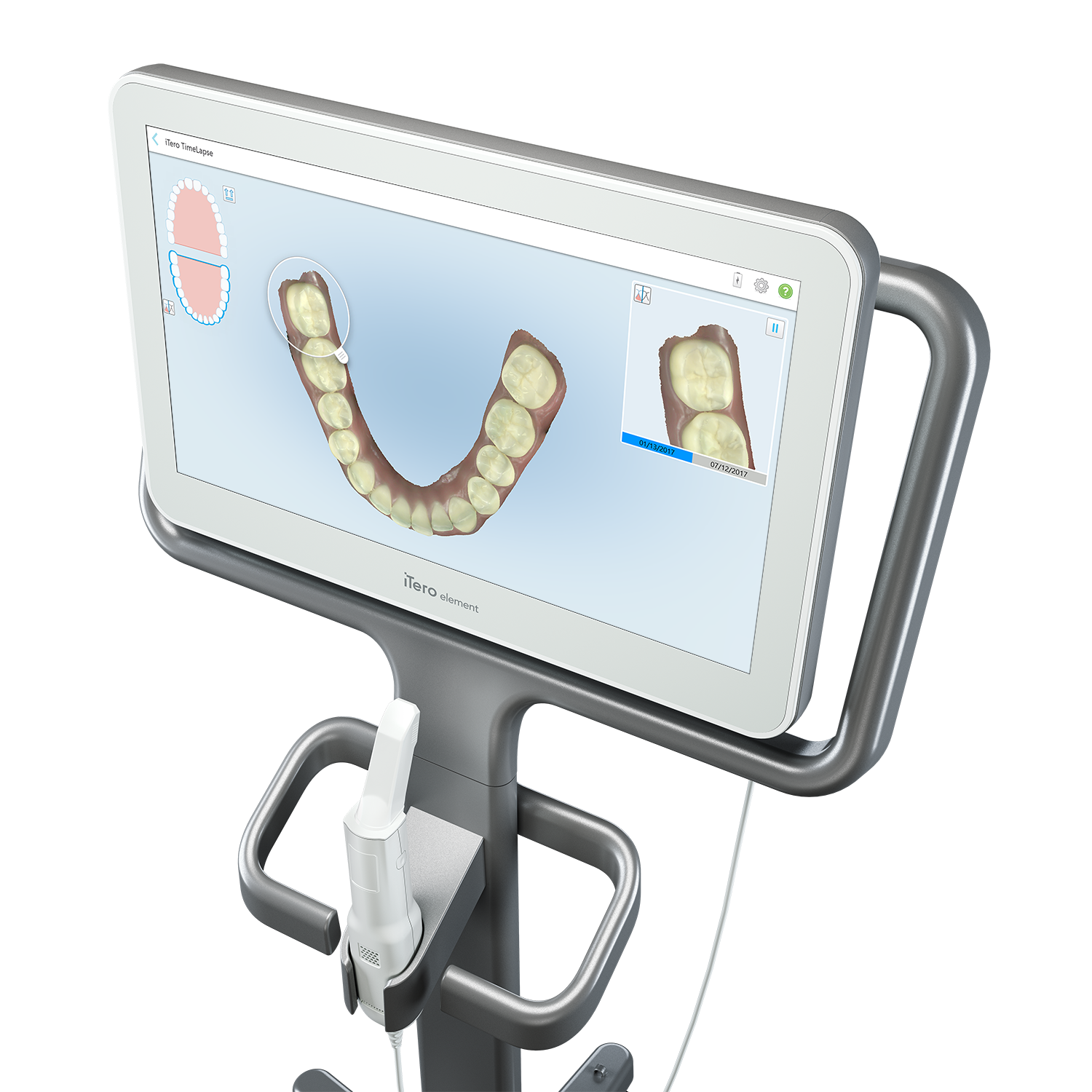 iTero Element 2 escáner intraoral