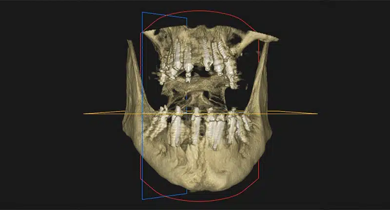 Muestra TAC Dental